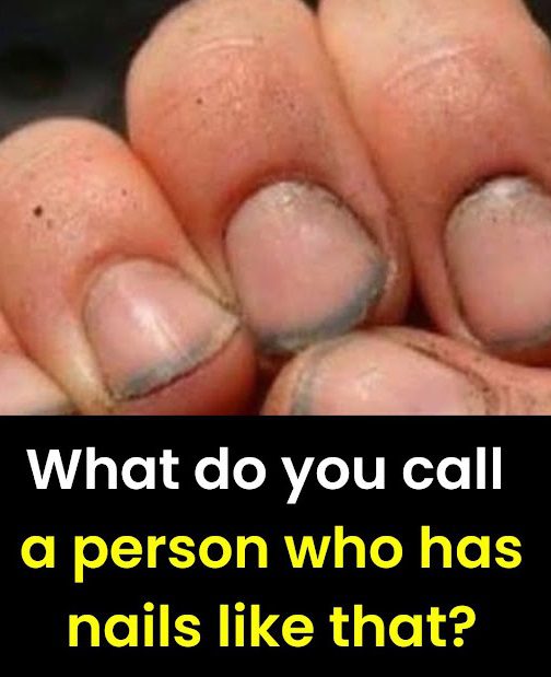 What do you call a person with nails like that?