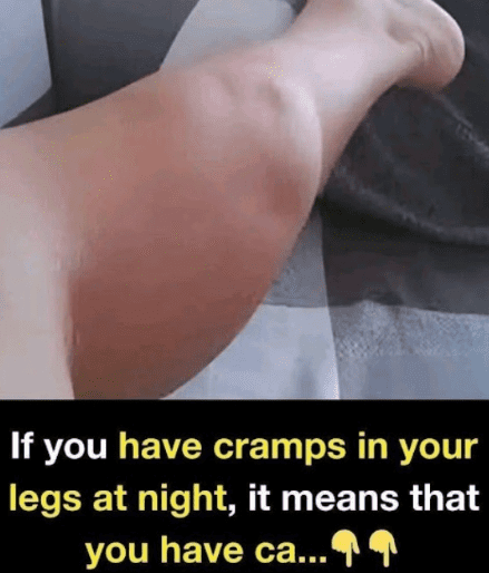 Who Is Most at Risk of Night Cramps?