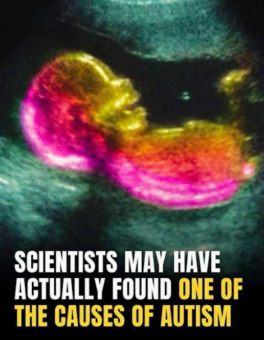 Scientists May Have Actually Found One Of The Causes Of Autism
