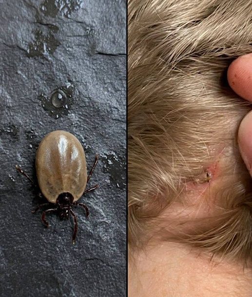 How to stay calm when you find unwanted “guests” in your child’s hair.