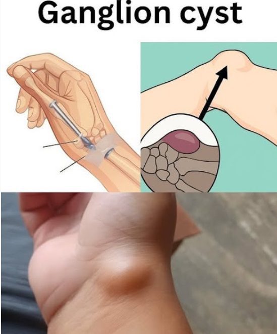 Healing Power And Important Safety Tips Of Castor Leaves