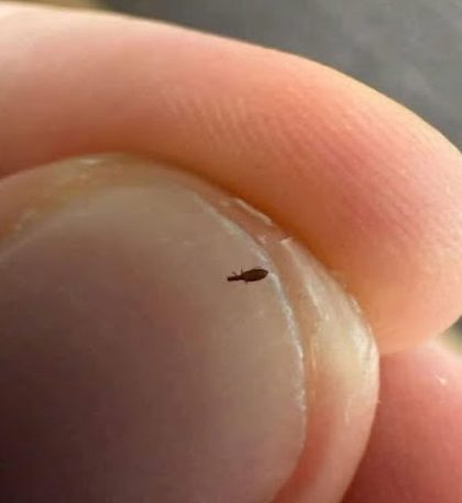 Bug Found in My Friend’s Hair: What Is It?