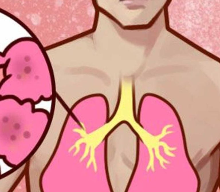 How to Ease Phlegm and Mucus at Home: Gentle Remedies and Safety Tips
