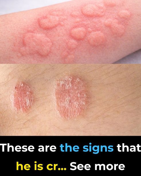 These are the signs that he is cr… See more